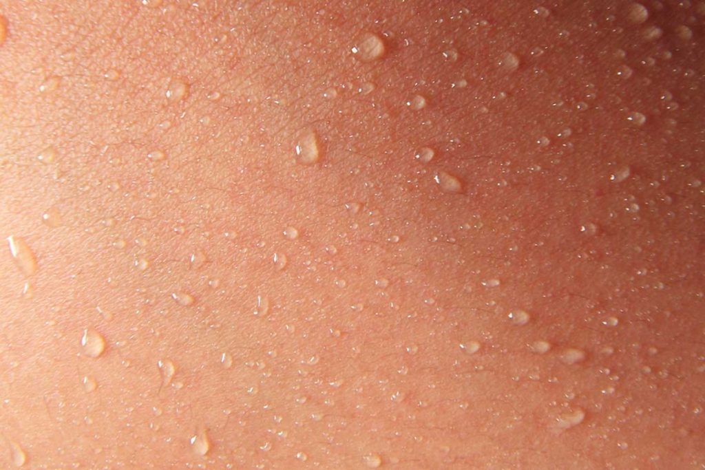 How To Deal With Excessive Sweating The London Dermatologist how-to-deal-with-excessive-sweating-the-london-dermatologist